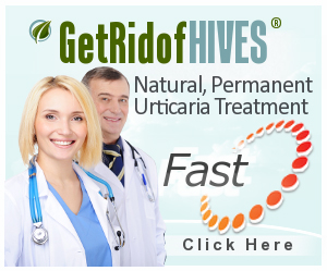 Get Rid Of Hives