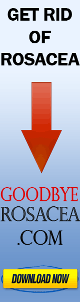 Goodbye Rosacea