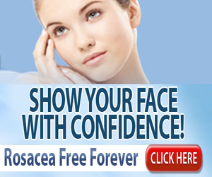 Rosacea Free