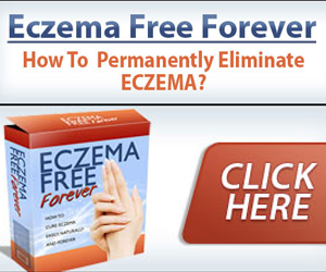Ezcema Free