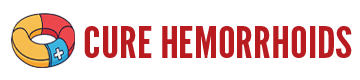 Cure Your Hemorrhoids