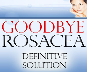 Goodbye Rosacea